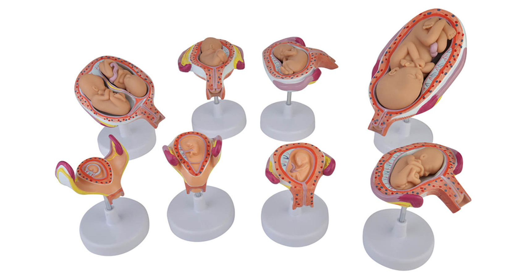 Uterul în perioada sarcinii - bdidact.ro
